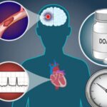 Early Anticoagulation in Severe Stroke with AF: Experts Weigh In