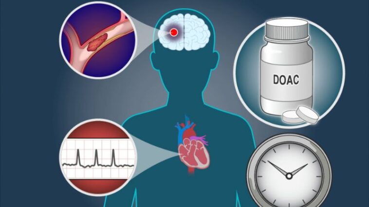 Early Anticoagulation in Severe Stroke with AF: Experts Weigh In