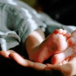 Fetal blood transfusion for the first time in India