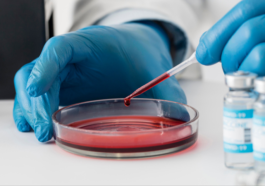 What Is The Most Rare Blood Type In The World