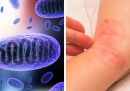 Fungal Infections Evolve into Silent Pandemic