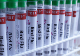 Resident Of Missouri Infected with Bird Flu Had no Contact With Animal