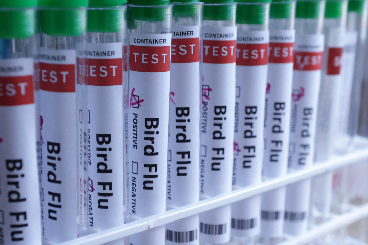 Resident Of Missouri Infected with Bird Flu Had no Contact With Animal